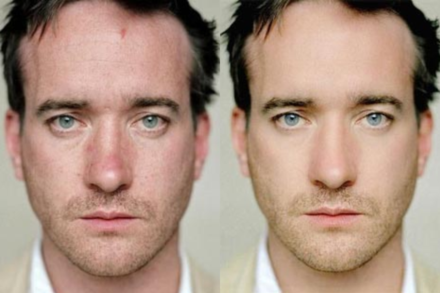 Side-by-side close-up portraits of a man with blue eyes, dark hair, and light stubble. The left image shows visible redness on his nose and a small mark on his forehead, while the right image appears smoother with blemishes and redness removed.